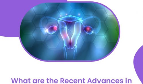 What are the recent advances in female fertility treatment methods? Advances in female fertility treatment methods as per the experts of Kiran Infertility Centre Hyderabad, especially in the case of IVF with the use of donor eggs, are helping people who are older or who do not have ovaries or those who have undergone premature ovarian failure to have a biological child. PGS\PGD testing can help determine the abnormal embryos and as a result, can increase the chances of a successful pregnancy. KIC uses the most advanced and top-notch technologies in the world. That’s the reason for our high success rate. For more Details Visit: https://kiranivfgenetic.com or mail us info@kiranivfgenetic.com Contact us: +91-9908392452 #Follicularscan #ivf #ivfbabies #pregnancy #infertiliity #femaleinfertility #kichyderabad #infertilityawarenesss #maleinfertility #surrogacyindia #surrogacylawsindia #ivfinindia #eggdonorsurrogacy #surrogacyhyderabad