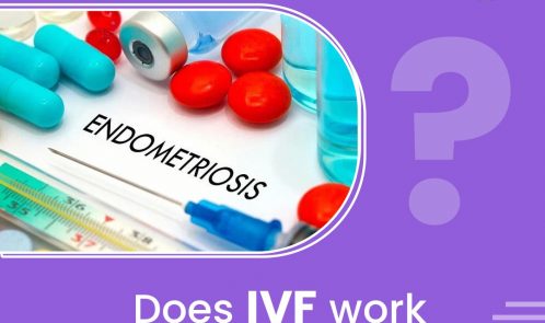 Does IVF work well in cases of Endometriosis?