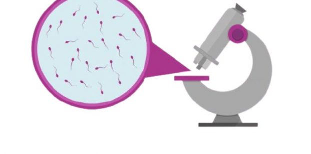 The necessity of Semen analysis in case of Infertility treatment in men