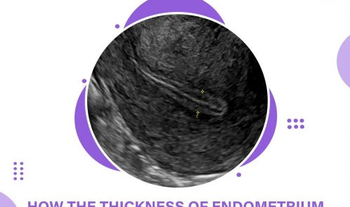 How the thickness of the endometrium is measured?