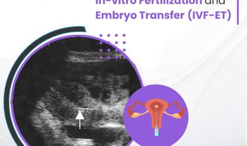 The role of ultrasonography in in-vitro fertilization and embryo transfer (IVF-ET)