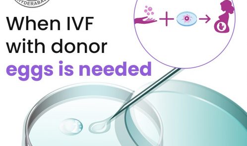 When IVF with donor eggs is needed