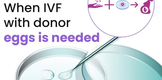 When IVF with donor eggs is needed