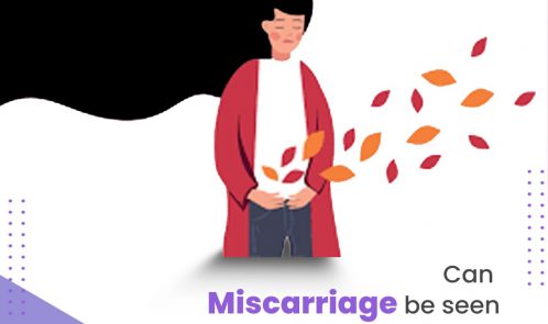 Can miscarriage be seen as a sign or symptom of infertility?