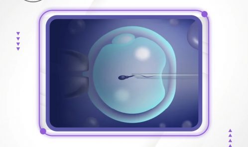 Here are the reasons why doctors recommend you to opt for the ICSI treatment