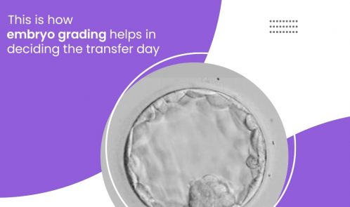 This is how embryo grading helps in deciding the transfer day