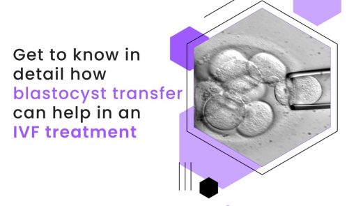 Get to know in detail how blastocyst transfer can help in an IVF treatment