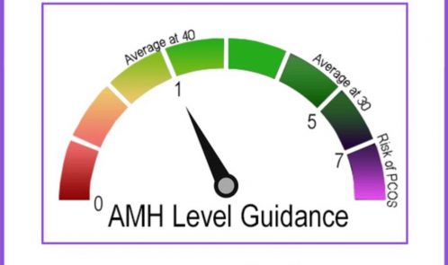 High AMH level- what does it mean