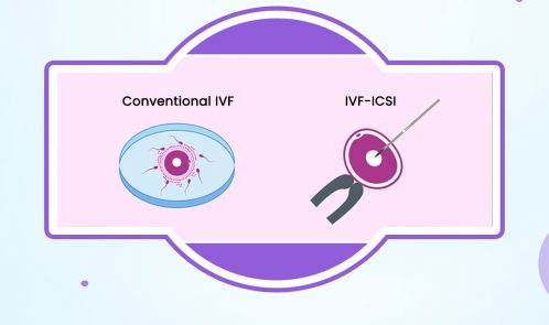 What is the process of fertilization in IVF