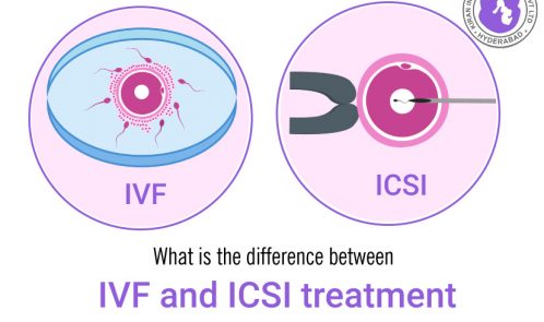 What is the difference between IVF and ICSI treatment