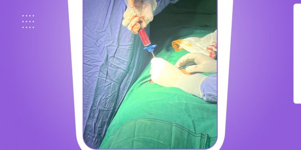 Stem cells for ovarian rejuvenation