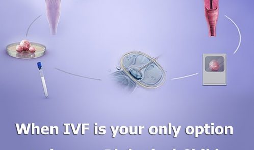 When IVF is your only option to have a biological child