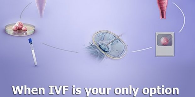 When IVF is your only option to have a biological child