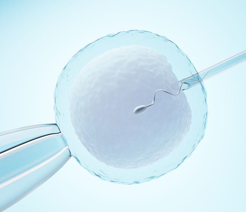 ICSI procedure showing direct sperm injection into egg for fertilization
