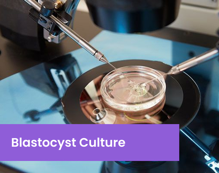 Embryo development from fertilization to blastocyst stage in IVF treatment